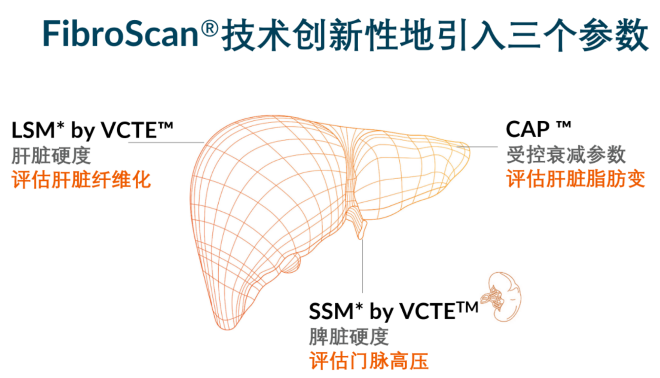 喜讯！FDA扩大了FibroScan?在肝脏综合管理中的应用范围